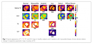 図２　各種疾患と定量評価パラメーターの変化　　 文献[1] より引用